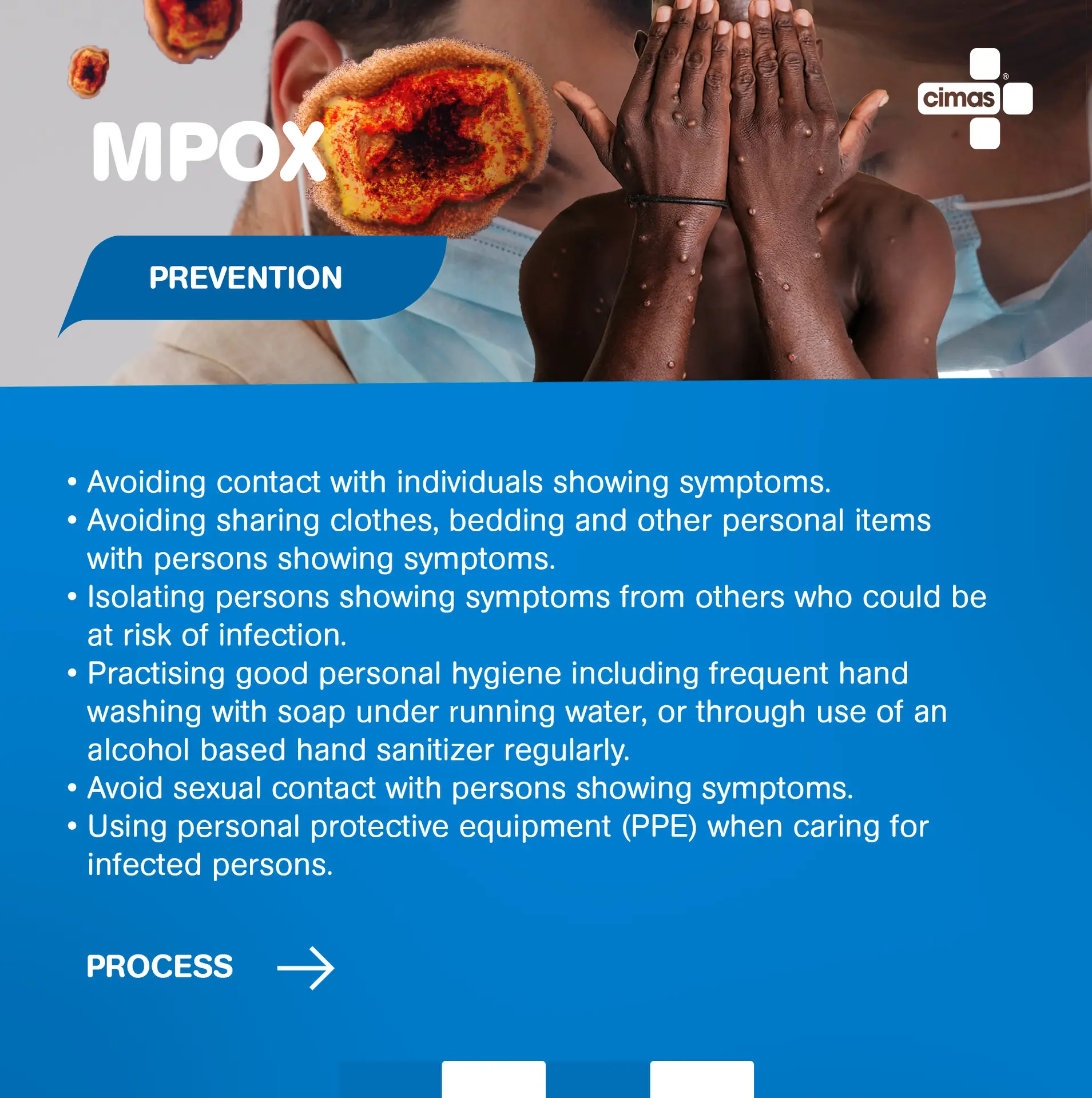 Mpox Prevention