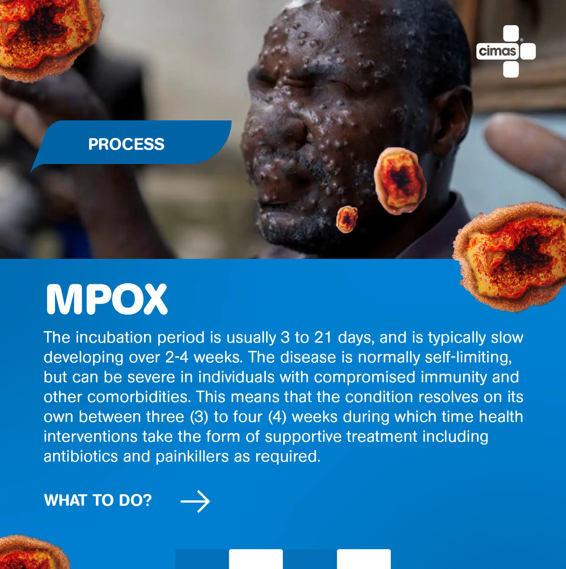 Mpox Process