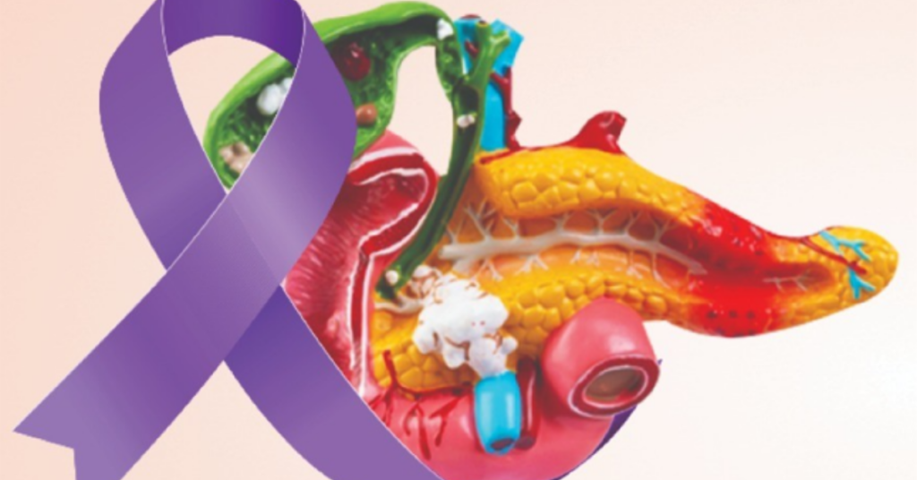 Pancreatic Cancer