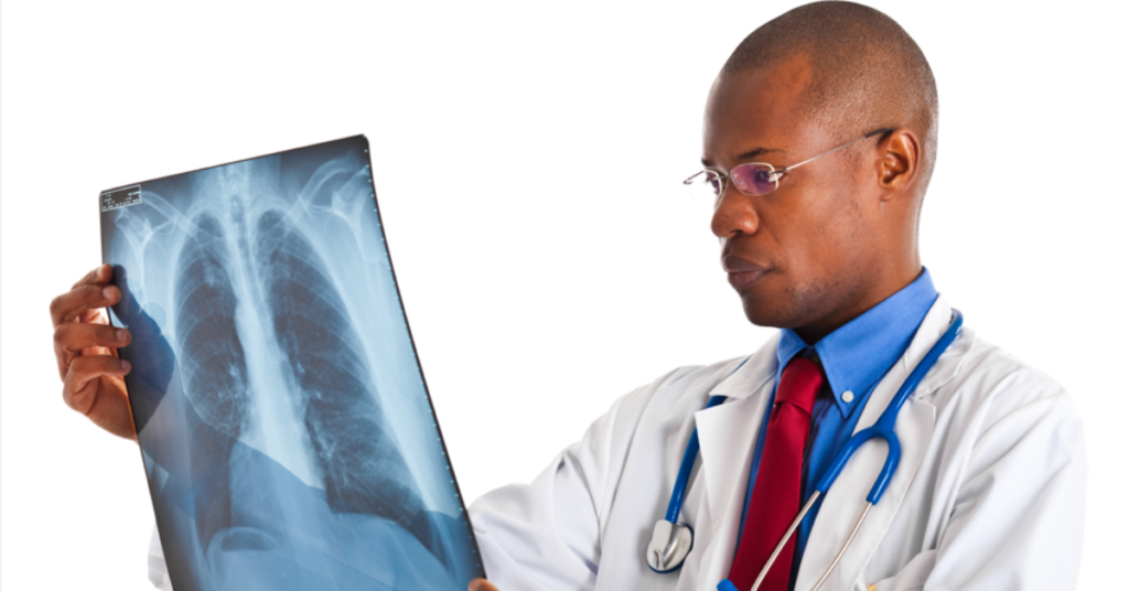 Pneumonia